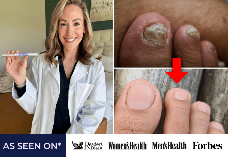 Orivelle Anti-Fungal Pen