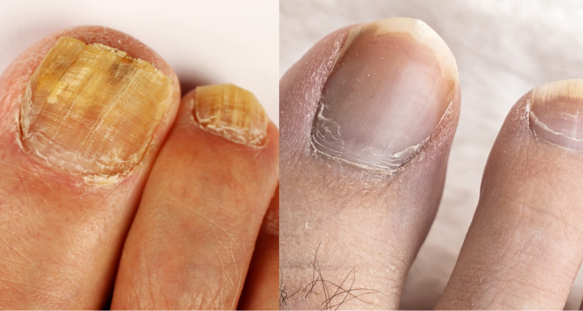 Before and After results